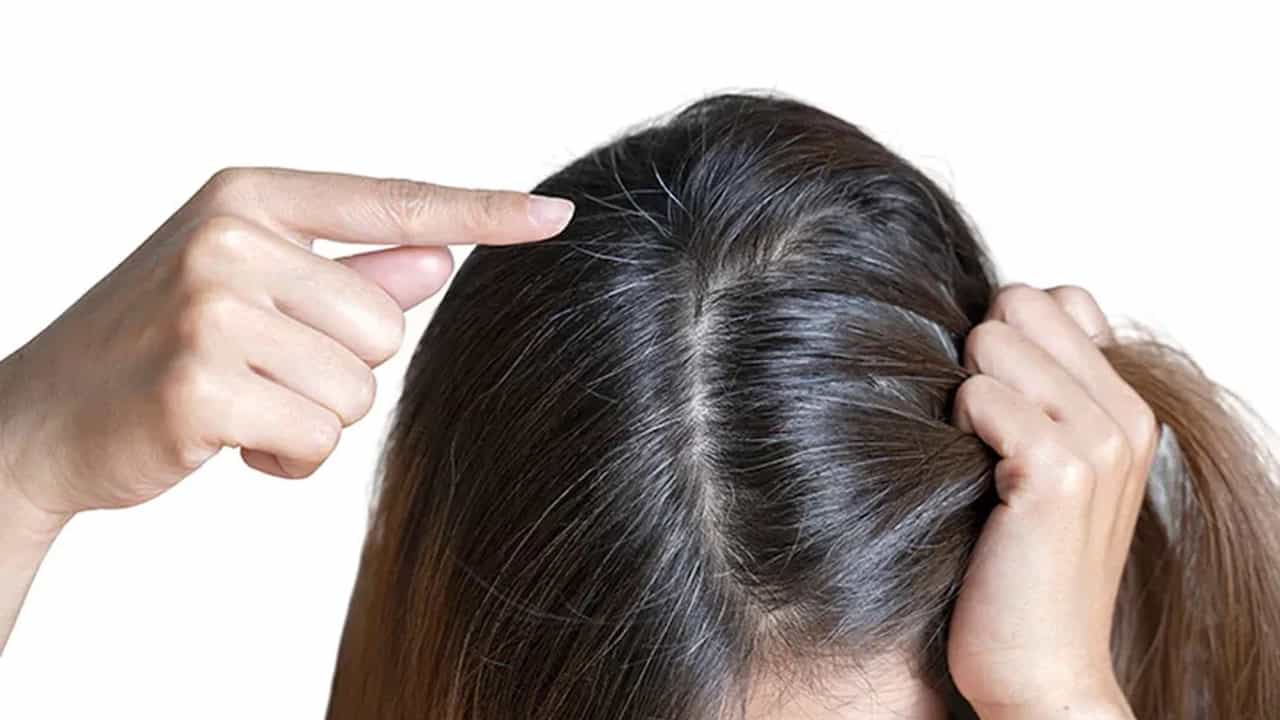 Dandruff: ਵਾਲਾਂ ਤੋਂ ਡੈਂਡਰਫ ਨੂੰ ਦੂਰ ਕਰਨ ਲਈ ਕਾਰਗਰ ਹੈ ਮੇਥੀ