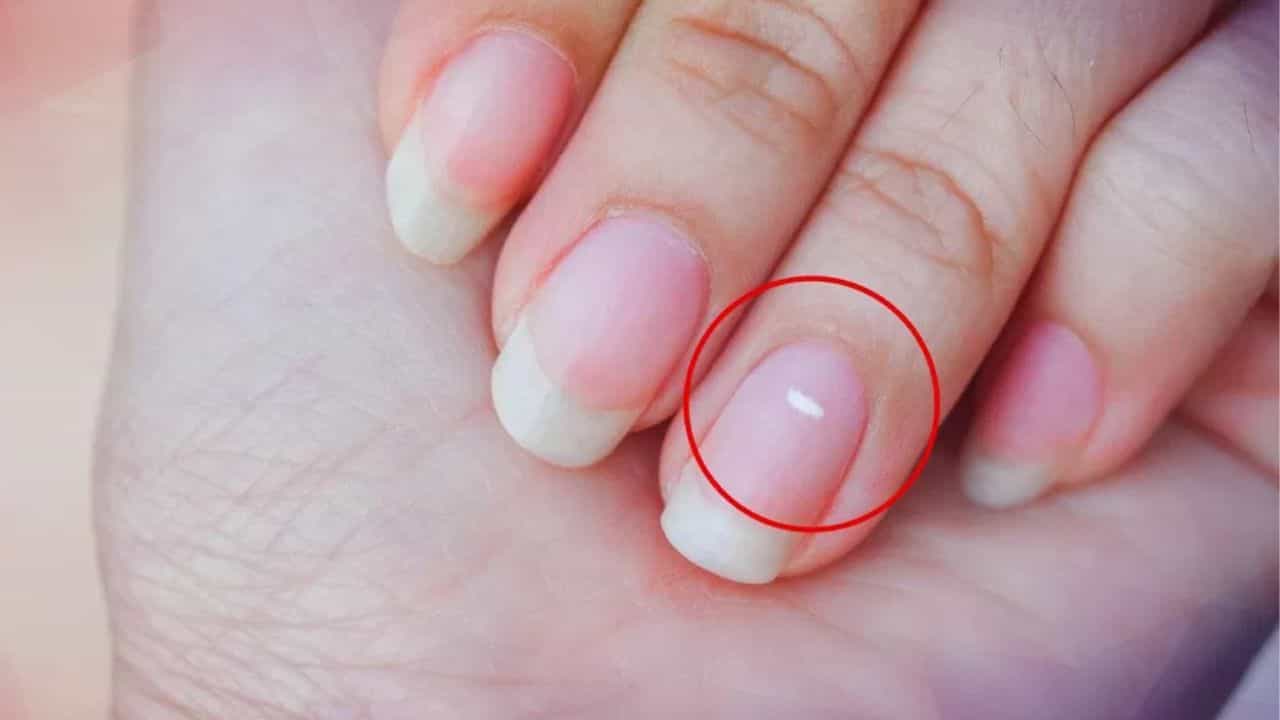 ਜੇਕਰ ਤੁਹਾਡੇ ਨਹੁੰਆਂ ਤੇ ਇਸ ਤਰ੍ਹਾਂ ਦੇ ਧੱਬੇ ਹਨ ਤਾਂ ਇਸਦਾ ਮਤਲਬ ਜਾਣ ਲਉ