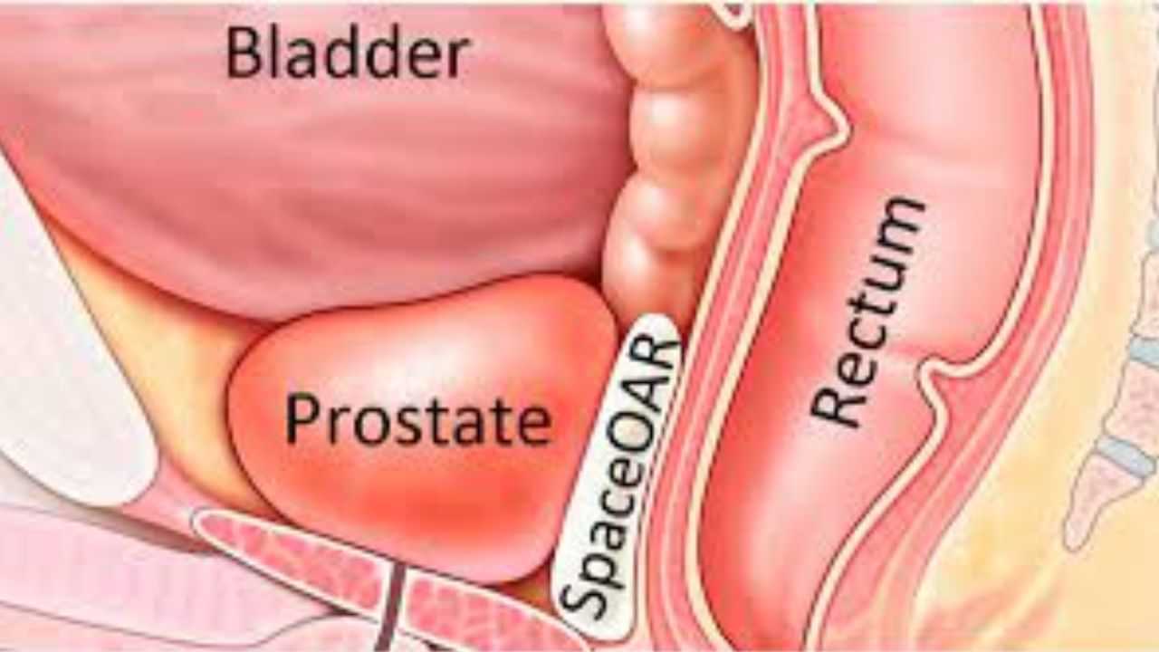 Bladder Cancer: ਇਨ੍ਹਾਂ ਲੱਛਣਾਂ ਨੂੰ ਨਜ਼ਰਅੰਦਾਜ਼ ਨਾ ਕਰੋ, ਹੋ ਸਕਦਾ ਹੈ ਬਲੈਡਰ ਕੈਂਸਰ