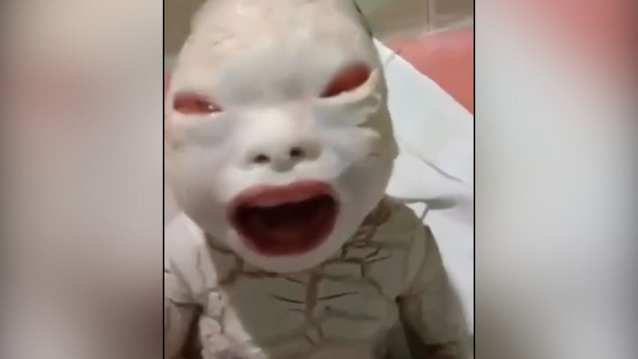 Shocking Video: ਹਸਪਤਾਲ ਵਿੱਚ ‘ਏਲੀਅਨ’ ਵਰਗੇ ਬੱਚੇ ਨੇ ਲਿਆ ਜਨਮ ਤਾਂ ਡਾਕਟਰਾਂ ਦੇ ਉੱਡ ਗਏ ਹੋਸ਼, ਦੇਖੋ ਹੈਰਾਨ ਕਰ ਦੇਣ ਵਾਲਾ ਵੀਡੀਓ Shocking Video: ਹਸਪਤਾਲ ਵਿੱਚ ‘ਏਲੀਅਨ’ ਵਰਗੇ ਬੱਚੇ ਨੇ ਲਿਆ ਜਨਮ ਤਾਂ ਡਾਕਟਰਾਂ ਦੇ ਉੱਡ ਗਏ ਹੋਸ਼, ਦੇਖੋ ਹੈਰਾਨ ਕਰ ਦੇਣ ਵਾਲਾ ਵੀਡੀਓ