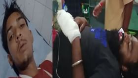 Firing in Jalandhar: ਜ਼ਮੀਨੀ ਵਿਵਾਦ ਕਾਰਨ ਜਲੰਧਰ ‘ਚ ਫਾਈਰਿੰਗ, ਇੱਕ ਰਾਹਗੀਰ ਸਣੇ ਤਿੰਨ ਲੋਕ ਜ਼ਖਮੀ...