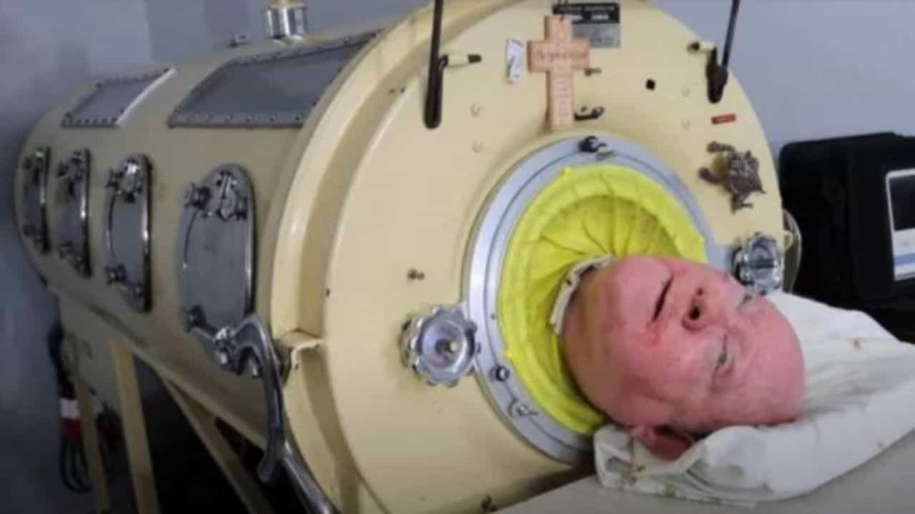 OMG: 70 ਸਾਲ ਤੋਂ ਲੋਹੇ ਦੇ ਫੇਫੜਿਆਂ ਨਾਲ ਜਿਉਂਦਾ ਹੈ ਇਹ ਸਖਸ਼, ਕਾਬਲੀਅਤ ਵੇਖ ਕਰੋਗੇ ਸੈਲਿਊਟ