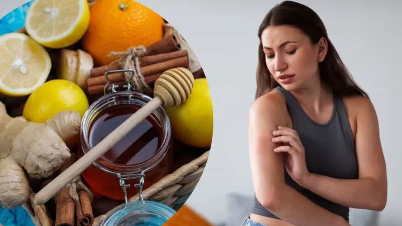 Beauty Tips: ਇਹ ਘਰੇਲੂ ਚੀਜ਼ਾਂ SKIN ਦੇ ਧੱਫੜ ਅਤੇ ਖਾਰਸ਼ ਤੋਂ ਰਾਹਤ ਦਿਵਾਉਣਗੀਆਂ