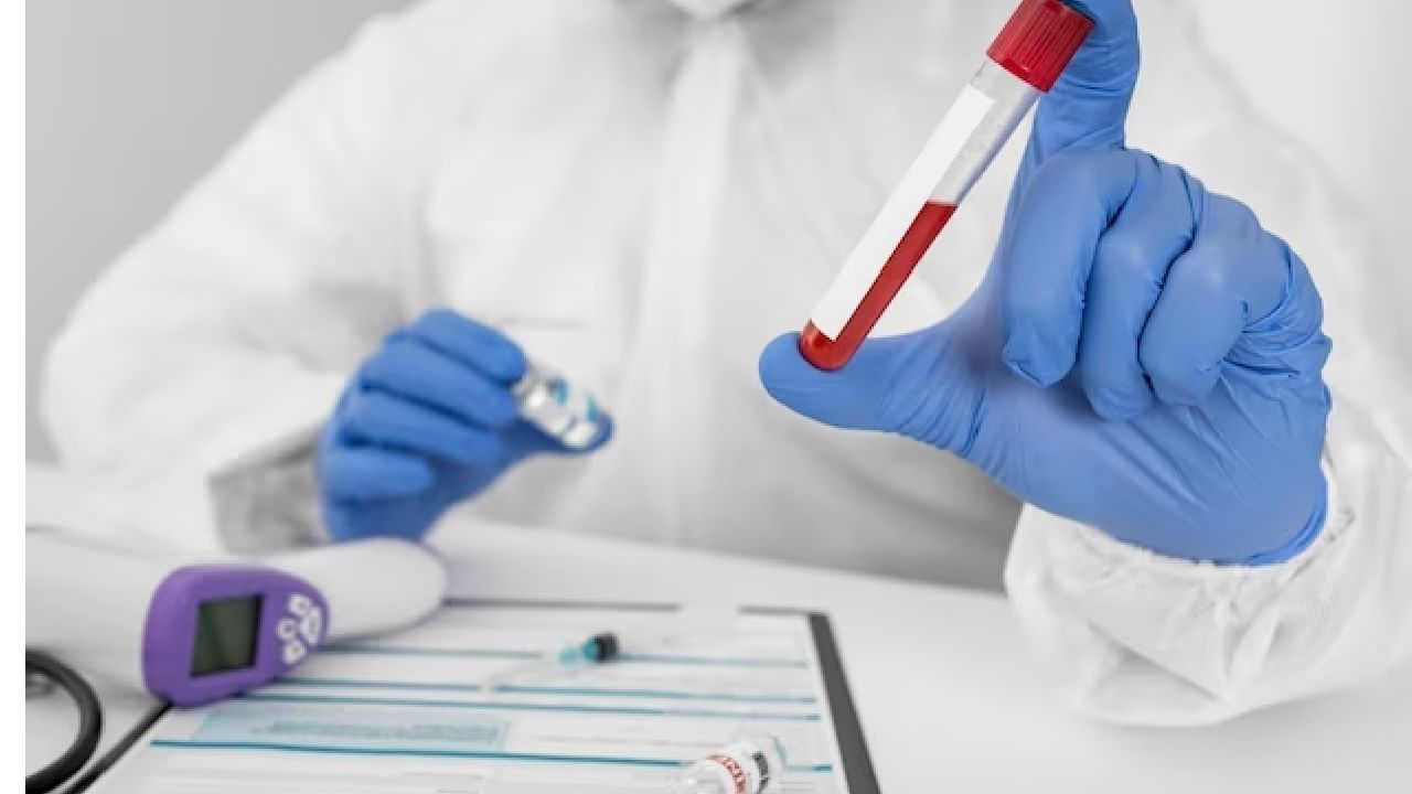 aids test