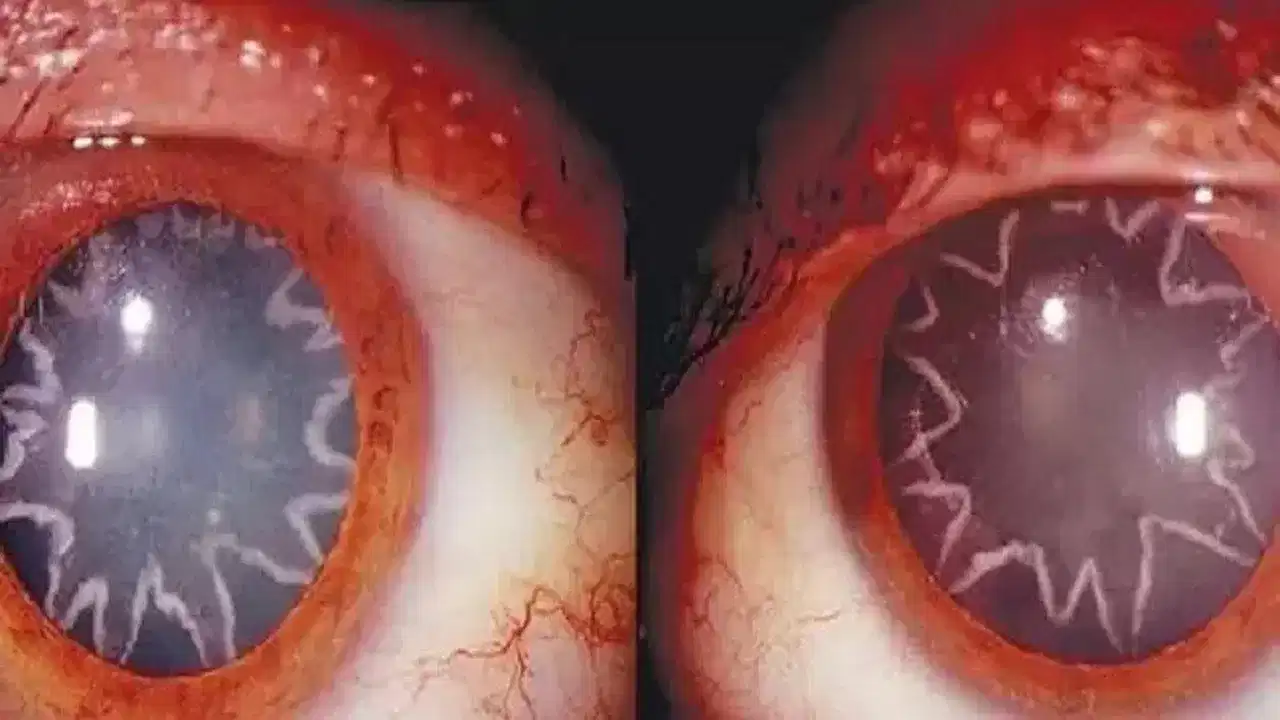 OMG! ਇੱਕ ਵਿਅਕਤੀ ਨਾਲ ਵਾਪਰਿਆ ਅਜਿਹਾ ਭਿਆਨਕ ਹਾਦਸਾ, ਅਜੀਬ ਜਿਹੀਆਂ ਹੋ ਗਈਆਂ ਅੱਖਾਂ OMG! ਇੱਕ ਵਿਅਕਤੀ ਨਾਲ ਵਾਪਰਿਆ ਅਜਿਹਾ ਭਿਆਨਕ ਹਾਦਸਾ, ਅਜੀਬ ਜਿਹੀਆਂ ਹੋ ਗਈਆਂ ਅੱਖਾਂ