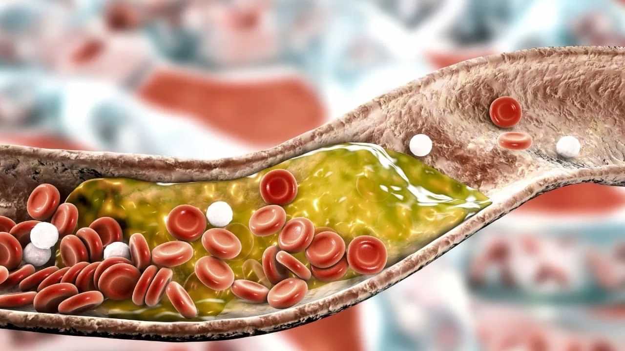 Bad Cholesterol: ਗਰਮੀਆਂ ਵਿੱਚ ਵਧਦੇ ਕੋਲੈਸਟ੍ਰੋਲ ਨੂੰ ਕਿਵੇਂ ਰੋਕੀਏ? ਮਾਹਿਰਾਂ ਨੇ ਦੱਸੇ ਆਸਾਨ ਟਿਪਸ