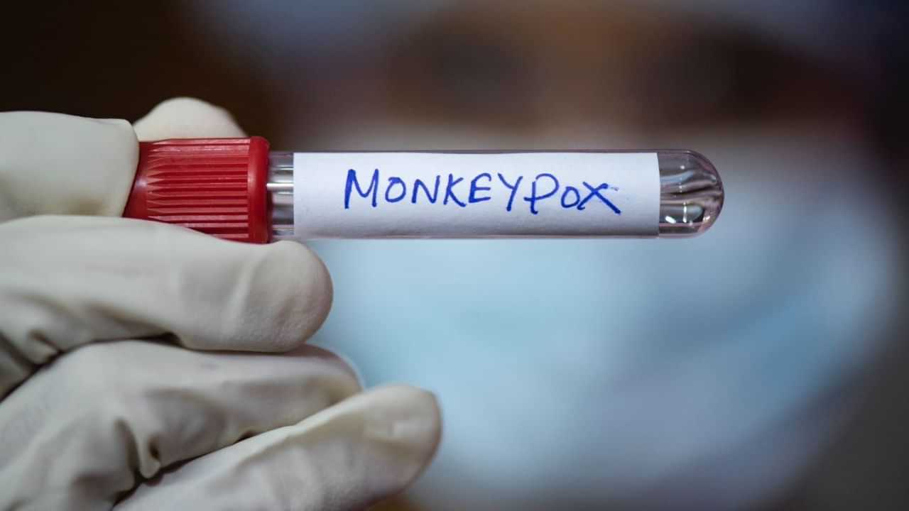 Monkeypox: ਫਿਰ ਫੈਲ ਰਿਹਾ ਹੈ ਮੰਕੀਪਾਕਸ ਵਾਇਰਸ, ਅਫਰੀਕਾ ਵਿੱਚ ਲਗਾਤਾਰ ਵੱਧ ਰਹੇ ਮਾਮਲੇ, ਕਿੰਨਾ ਹੈ ਖ਼ਤਰਾ?