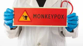 Monkeypox : ਅਫਰੀਕਾ ਤੋਂ ਪਾਕਿਸਤਾਨ ਪਹੁੰਚਿਆ ਮੰਕੀਪੌਕਸ, ਭਾਰਤ ‘ਚ ਵੀ ਖਤਰਾ, ਹਸਪਤਾਲ-ਏਅਰਪੋਰਟ ‘ਤੇ ਅਲਰਟ