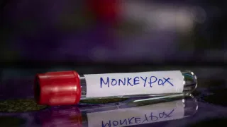 Monkeypox: ਬੈਂਗਲੁਰੂ ਹਵਾਈ ਅੱਡਾ ਅਲਰਟ ‘ਤੇ : Mpox ਪ੍ਰਕੋਪ ਦੇ ਵਿਚਾਲੇ ਕਈ ਯਾਤਰੀਆਂ ਦੇ ਕੀਤੇ ਗਏ ਟੈਸਟ