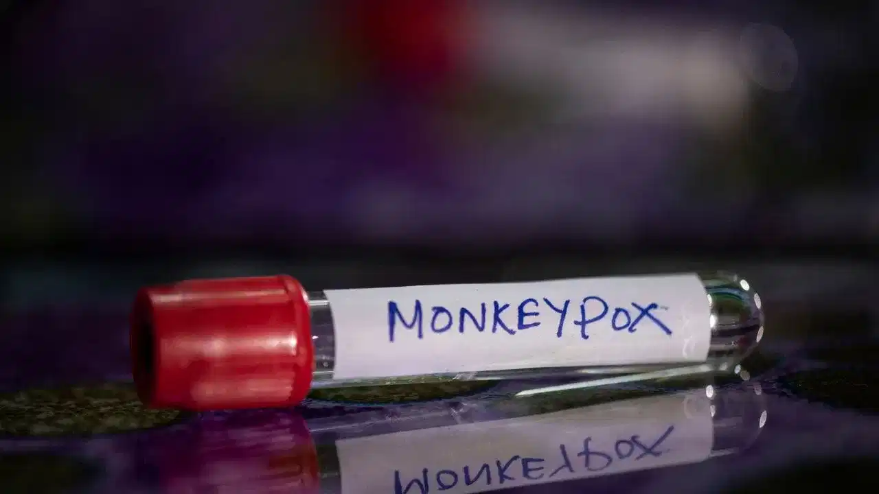 Monkeypox: ਕੇਰਲ ਦੇ ਮੱਲਪੁਰਮ ਵਿੱਚ ਐਮਪੌਕਸ ਦਾ ਮਾਮਲਾ, ਦੁਬਈ ਤੋਂ ਆਇਆ ਵਿਅਕਤੀ