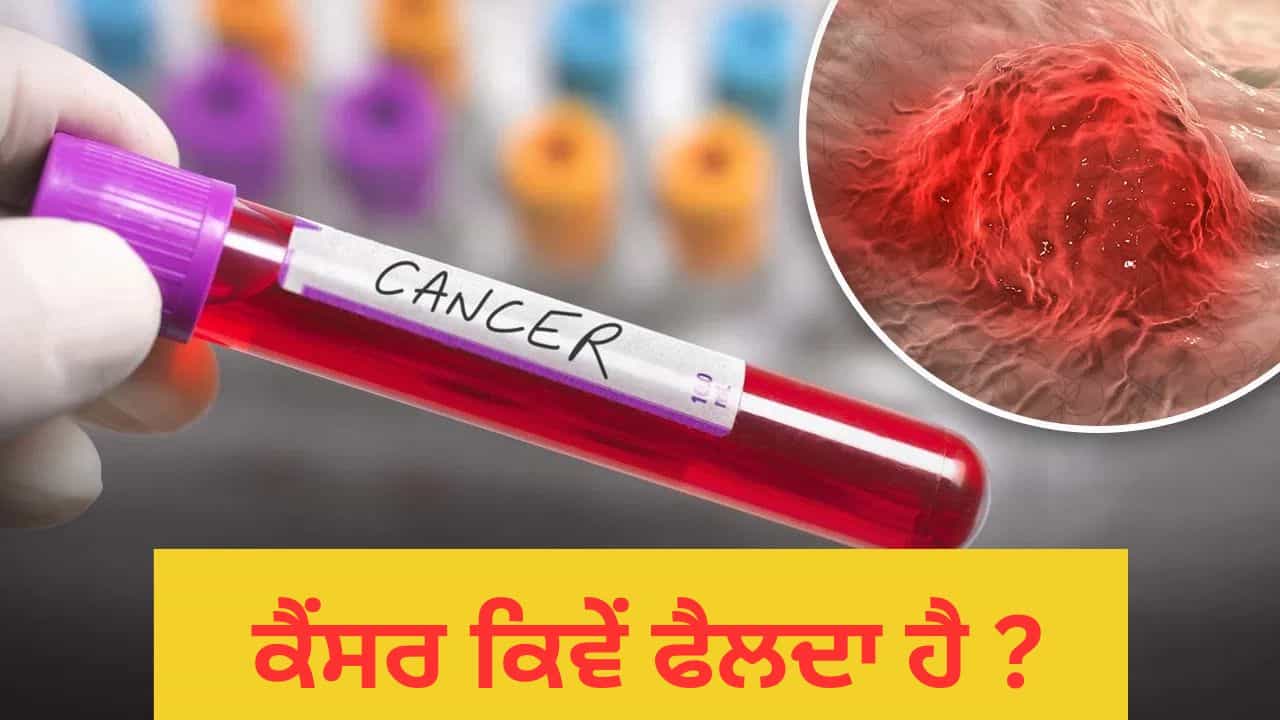 ਕੈਂਸਰ ਸਰੀਰ ਵਿੱਚ ਕਿਵੇਂ ਫੈਲਦਾ ਹੈ? ਇਸਦਾ ਆਕਸੀਜਨ ਦੀ ਘਾਟ ਨਾਲ ਕੀ ਸਬੰਧ ਹੈ? ਕੈਂਸਰ ਸਰੀਰ ਵਿੱਚ ਕਿਵੇਂ ਫੈਲਦਾ ਹੈ? ਇਸਦਾ ਆਕਸੀਜਨ ਦੀ ਘਾਟ ਨਾਲ ਕੀ ਸਬੰਧ ਹੈ?