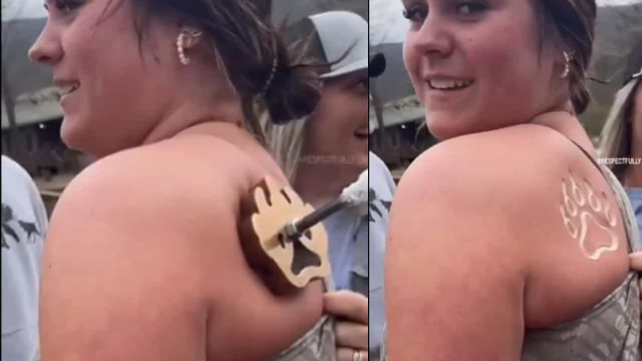 OMG: ਟੈਟੂ ਲਈ ਔਰਤ ਨੇ ਸਾੜ ਲਿਆ ਆਪਣਾ ਸਰੀਰ, VIDEO ਦੇਖ ਕੰਬ ਜਾਓਗੇ