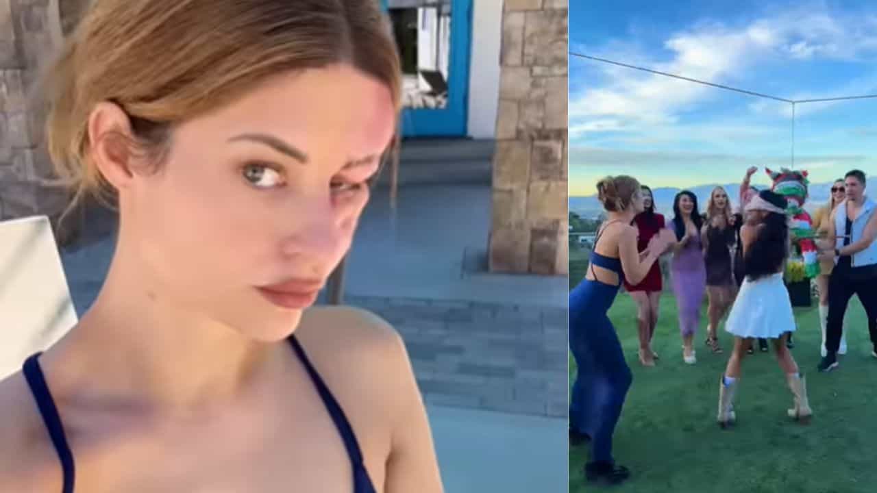 Viral Video: ਖੇਡ-ਖੇਡ ਚ ਔਰਤ ਦੀ ਫੁੱਟ ਗਈ ਅੱਖ, ਸਹੇਲੀ ਸਾਹਮਣੇ ਕੀਤੀ ਇਹ ਵੱਡੀ ਗਲਤੀ... ਦੇਖੋ