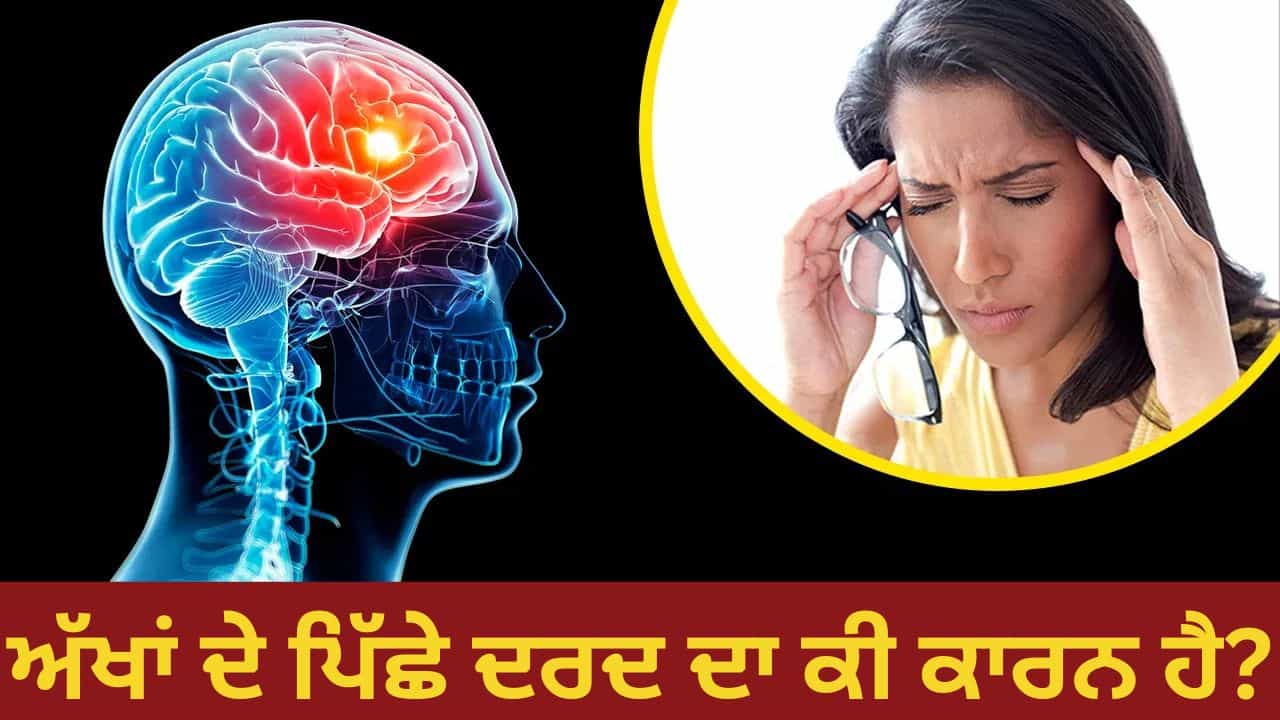 ਕੀ ਤੁਹਾਨੂੰ ਵੀ ਅੱਖਾਂ ਦੇ ਪਿੱਛੇ ਸਿਰ ਚ ਦਰਦ ਰਹਿੰਦਾ ਹੈ? ਇਹ ਹੋ ਸਕਦਾ ਹੈ ਇਹਨਾਂ ਬਿਮਾਰੀਆਂ ਦਾ ਲੱਛਣ