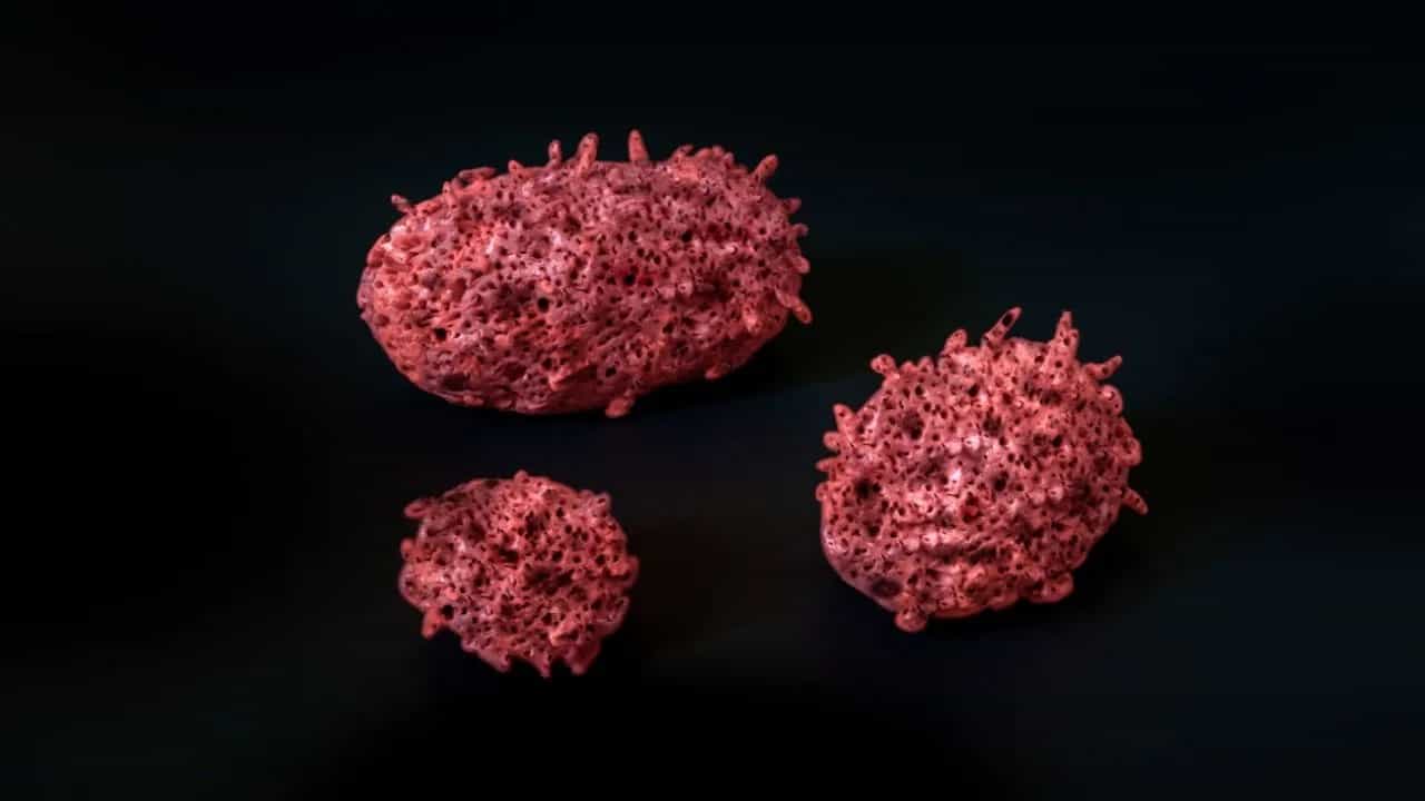 ਅਮਰੀਕਾ ਵਿੱਚ ਤੇਜ਼ੀ ਨਾਲ ਫੈਲ ਰਿਹਾ ਇਹ ਵਾਇਰਸ, 50 ਤੋਂ ਵੱਧ ਇਲਾਕਿਆਂ ਵਿੱਚ ਮਾਮਲੇ, 70 ਨਵੇਂ ਕੇਸ