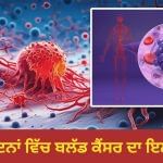 9 ਦਿਨਾਂ ਵਿੱਚ ਬਲੱਡ ਕੈਂਸਰ ਦਾ ਇਲਾਜ! ਡਾਕਟਰਾਂ ਨੇ ਰੱਚਿਆ ਇਤਿਹਾਸ, ICMR ਦੀ ਰਿਸਰਚ 9 ਦਿਨਾਂ ਵਿੱਚ ਬਲੱਡ ਕੈਂਸਰ ਦਾ ਇਲਾਜ! ਡਾਕਟਰਾਂ ਨੇ ਰੱਚਿਆ ਇਤਿਹਾਸ, ICMR ਦੀ ਰਿਸਰਚ