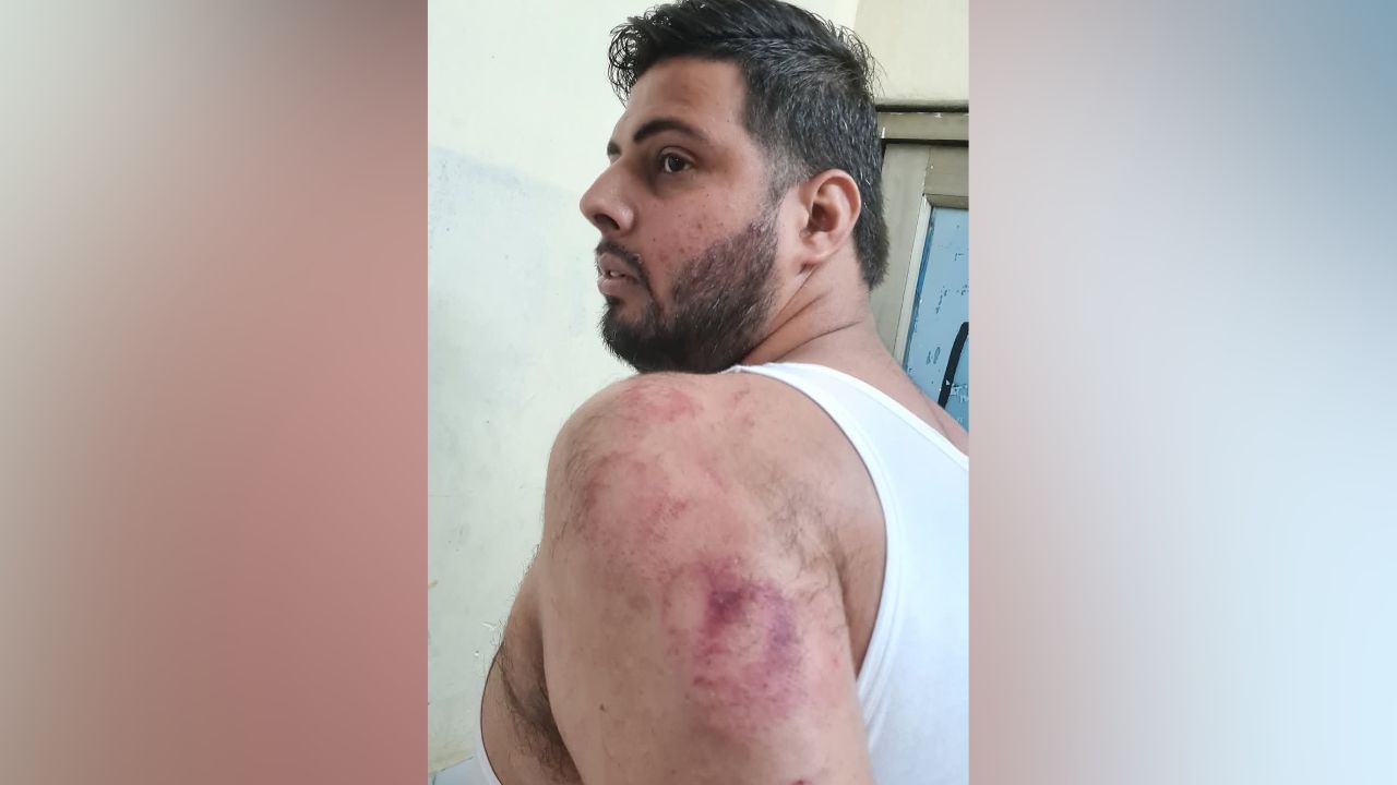 ਜਲੰਧਰ: ਪਾਰਕਿੰਗ ਨੂੰ ਲੈ ਕੇ ਕਾਂਗਰਸ ਦੇ ਕੌਂਸਲਰ 'ਤੇ ਆਪ ਆਗੂ ਵਿਚਕਾਰ ਝਗੜਾ, ਲੱਤਾਂ-ਮੁੱਕਿਆਂ ਨਾਲ ਕੀਤਾ ਹਮਲਾ