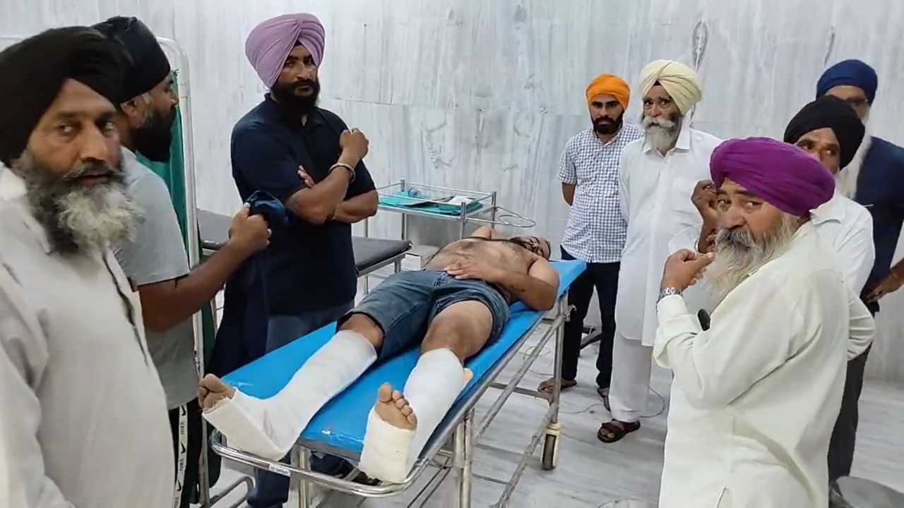 ਸਾਲੇ ਨੇ ਬਦਮਾਸ਼ਾਂ ਨਾਲ ਮਿਲ ਕੇ ਕੀਤਾ ਜੀਜੇ ਤੇ ਹਮਲਾ, ਤੋੜਿਆ ਪੈਰ ਸਾਲੇ ਨੇ ਬਦਮਾਸ਼ਾਂ ਨਾਲ ਮਿਲ ਕੇ ਕੀਤਾ ਜੀਜੇ ਤੇ ਹਮਲਾ, ਤੋੜਿਆ ਪੈਰ