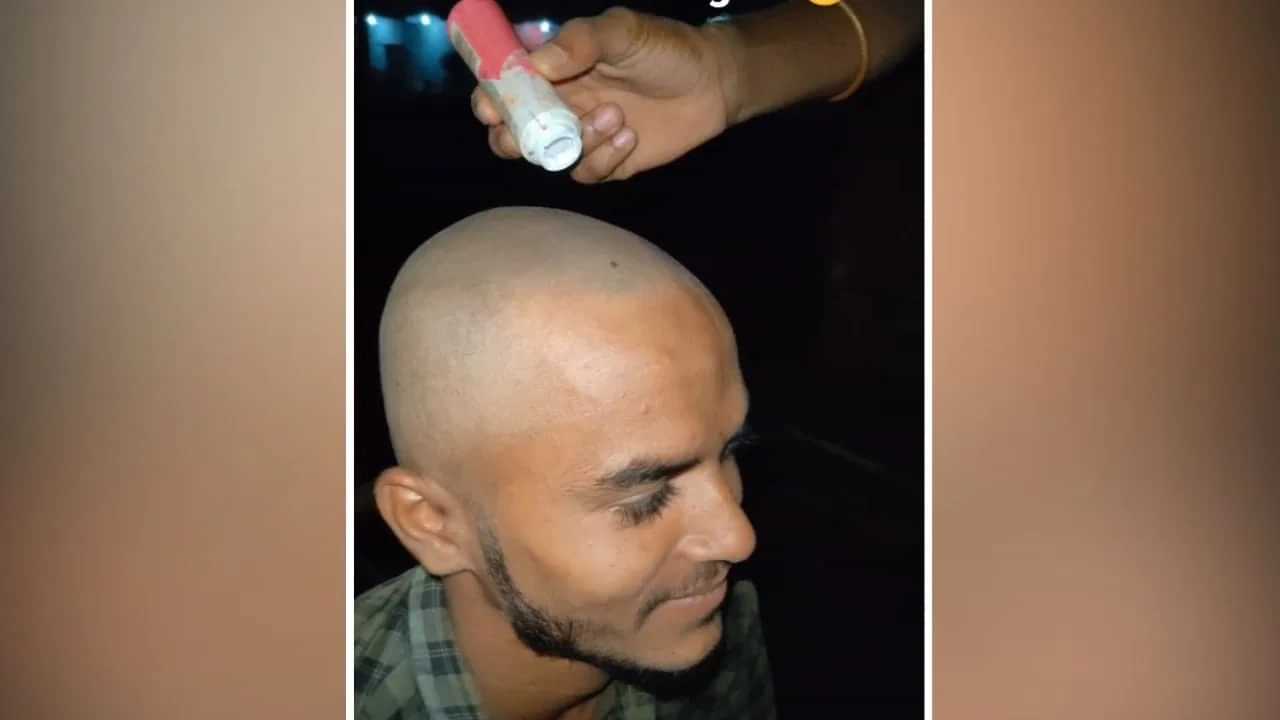 Viral: ਹਲਦੀ ਦਾ ਭੂਤ ਉੱਤਰਿਆ, ਹੁਣ ਟਕਲੀ ਟ੍ਰੈਂਡ ਨੇ ਮਚਾਇਆ ਤਹਿਲਕਾ! 9 ਕਰੋੜ ਲੋਕਾਂ ਨੇ ਵੇਖ ਲਿਆ Video Viral: ਹਲਦੀ ਦਾ ਭੂਤ ਉੱਤਰਿਆ, ਹੁਣ ਟਕਲੀ ਟ੍ਰੈਂਡ ਨੇ ਮਚਾਇਆ ਤਹਿਲਕਾ! 9 ਕਰੋੜ ਲੋਕਾਂ ਨੇ ਵੇਖ ਲਿਆ Video