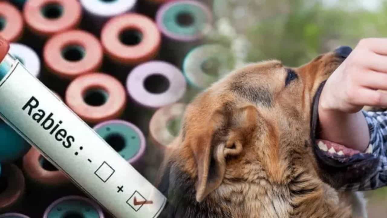 ਰੇਬੀਜ਼ ਕਿੰਨੀ ਖ਼ਤਰਨਾਕ ਬਿਮਾਰੀ? ਇੱਕ ਵਾਰ ਹੋਣ ਤੋਂ ਬਾਅਦ ਕਿਉਂ ਹੋ ਜਾਂਦੀ ਹੈ ਮੌਤ? ਰੇਬੀਜ਼ ਕਿੰਨੀ ਖ਼ਤਰਨਾਕ ਬਿਮਾਰੀ? ਇੱਕ ਵਾਰ ਹੋਣ ਤੋਂ ਬਾਅਦ ਕਿਉਂ ਹੋ ਜਾਂਦੀ ਹੈ ਮੌਤ?