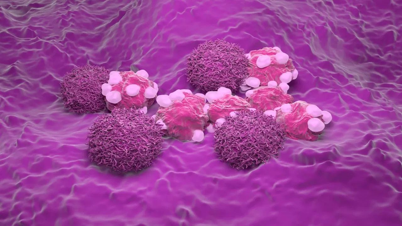 Cancer Symptoms: Cancer ਦੇ ਉਹ ਲੱਛਣ ਜਿਨ੍ਹਾਂ ਨੂੰ ਲੋਕ ਆਮ ਤੌਰ 'ਤੇ ਕਰਦੇ ਹਨ ਨਜ਼ਰਅੰਦਾਜ਼, ਜਾਣੋ ਡਾਕਟਰ ਕੋਲੋ ਇਸ ਦੇ ਸ਼ੁਰਆਤੀ ਲੱਛਣ