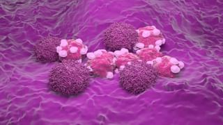 Cancer Symptoms: Cancer ਦੇ ਉਹ ਲੱਛਣ ਜਿਨ੍ਹਾਂ ਨੂੰ ਲੋਕ ਆਮ ਤੌਰ ‘ਤੇ ਕਰਦੇ ਹਨ ਨਜ਼ਰਅੰਦਾਜ਼, ਜਾਣੋ ਡਾਕਟਰ ਕੋਲੋ ਇਸ ਦੇ ਸ਼ੁਰਆਤੀ ਲੱਛਣ Cancer Symptoms: Cancer ਦੇ ਉਹ ਲੱਛਣ ਜਿਨ੍ਹਾਂ ਨੂੰ ਲੋਕ ਆਮ ਤੌਰ ‘ਤੇ ਕਰਦੇ ਹਨ ਨਜ਼ਰਅੰਦਾਜ਼, ਜਾਣੋ ਡਾਕਟਰ ਕੋਲੋ ਇਸ ਦੇ ਸ਼ੁਰਆਤੀ ਲੱਛਣ