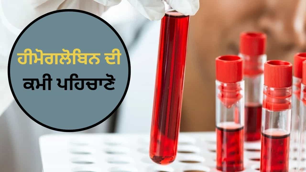 ਸਰੀਰ ਵਿੱਚ ਹੀਮੋਗਲੋਬਿਨ ਕਿਉਂ ਘੱਟ ਜਾਂਦਾ ਹੈ? ਕਮੀ ਦਾ ਕੀ ਹੈ ਖ਼ਤਰਾ, ਕੀ ਹਨ ਇਸ ਦੇ ਲੱਛਣ?