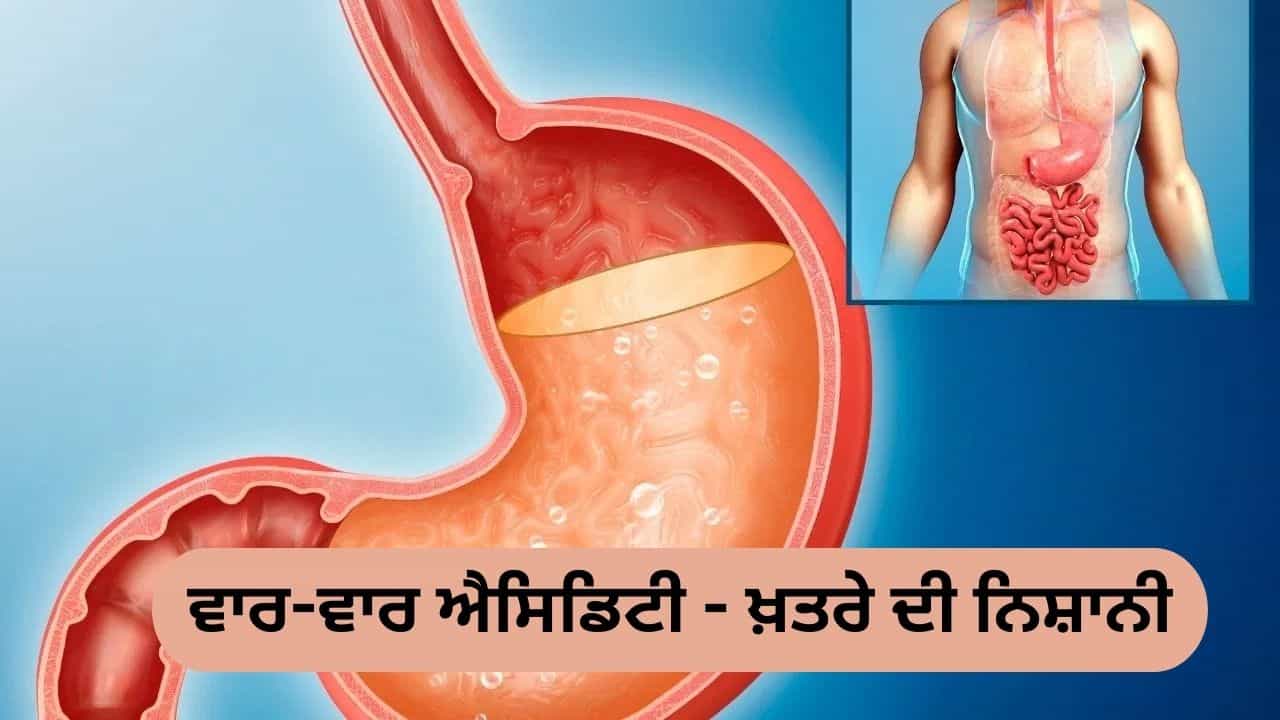 ਵਾਰ-ਵਾਰ ਐਸੀਡਿਟੀ ਹੋਣਾ ਕਿਹੜੀਆਂ ਬਿਮਾਰੀਆਂ ਦਾ ਸੰਕੇਤ ਹੋ ਸਕਦਾ ਹੈ? ਵਾਰ-ਵਾਰ ਐਸੀਡਿਟੀ ਹੋਣਾ ਕਿਹੜੀਆਂ ਬਿਮਾਰੀਆਂ ਦਾ ਸੰਕੇਤ ਹੋ ਸਕਦਾ ਹੈ?