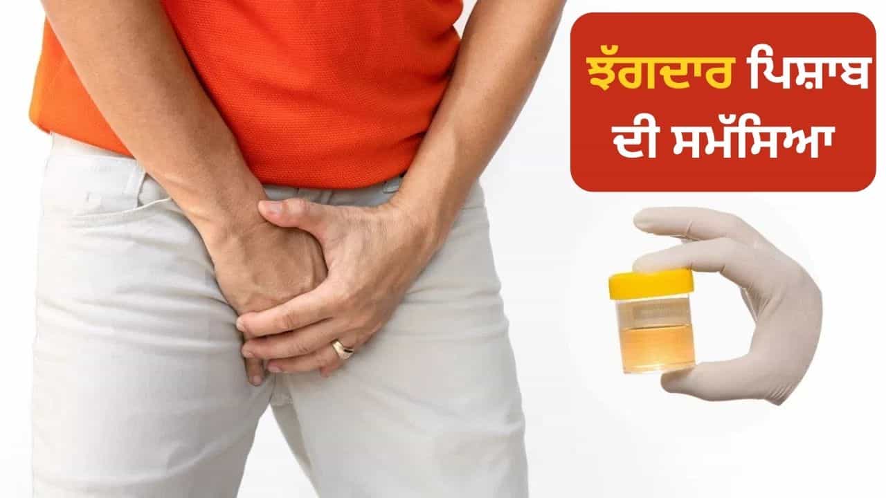 Urine ਵਿਚ ਝੱਗ ਆਉਣਾ ਕਿਸ ਬਿਮਾਰੀ ਦੇ ਲੱਛਣ ਹਨ? ਐਕਸਪਰਟ ਤੋਂ ਜਾਣੋ Urine ਵਿਚ ਝੱਗ ਆਉਣਾ ਕਿਸ ਬਿਮਾਰੀ ਦੇ ਲੱਛਣ ਹਨ? ਐਕਸਪਰਟ ਤੋਂ ਜਾਣੋ