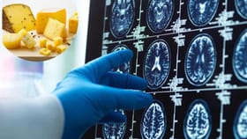 ਕਿਹੜੇ ਭੋਜਨ ਡਿਮੈਂਸ਼ੀਆ ਦੇ ਜੋਖਮ ਨੂੰ ਘਟਾਉਂਦੇ ਹਨ? ਨਵੀਂ ਖੋਜ ਵਿੱਚ ਖੁਲਾਸਾ