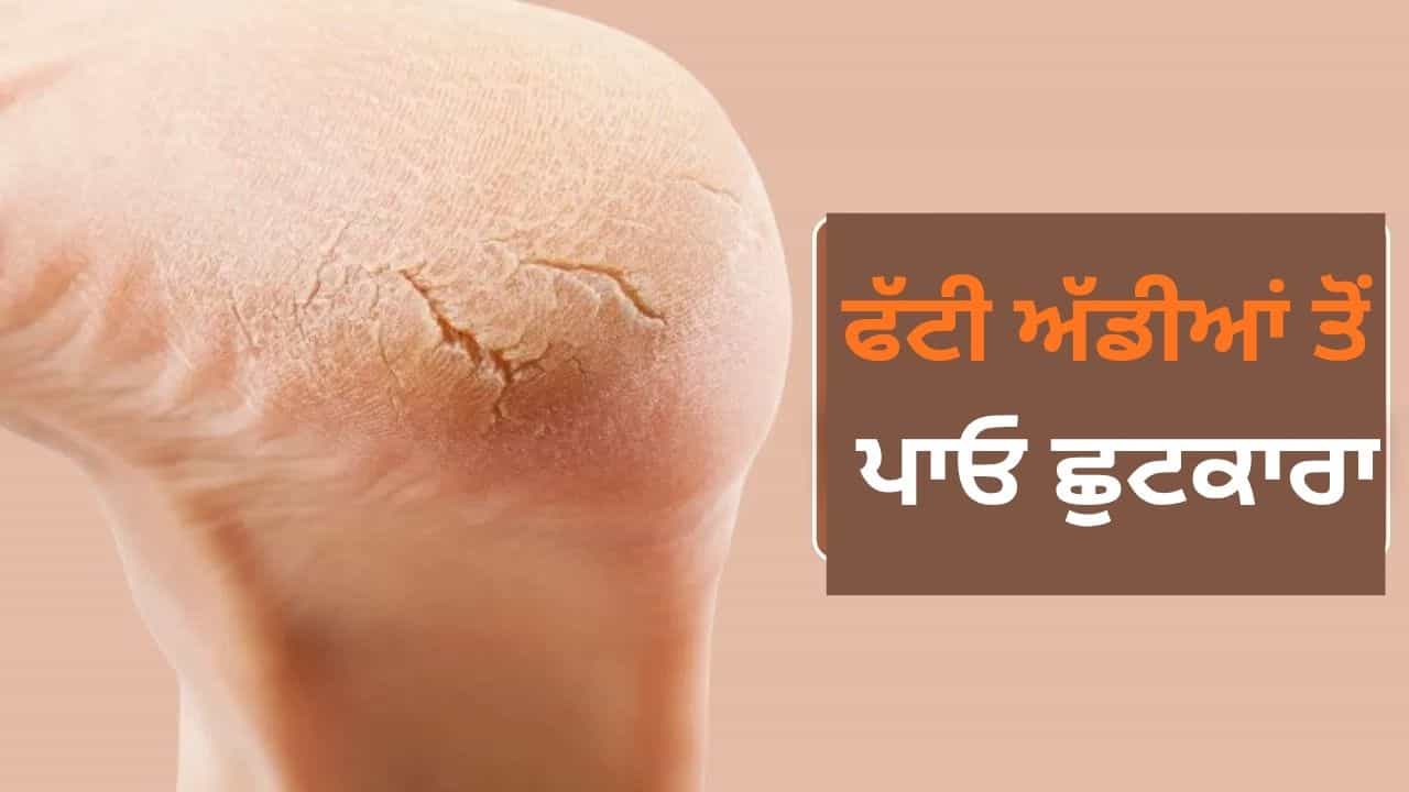 ਮਹਿੰਗੀ ਕ੍ਰੀਮ ਦੀ ਨਹੀਂ ਪਵੇਗੀ ਜ਼ਰੂਰਤ, ਕਰੋ ਇਹ ਉਪਾਅ ਅੱਡੀਆਂ ਹੋ ਜਾਣਗੀਆਂ ਨਰਮ ਮਹਿੰਗੀ ਕ੍ਰੀਮ ਦੀ ਨਹੀਂ ਪਵੇਗੀ ਜ਼ਰੂਰਤ, ਕਰੋ ਇਹ ਉਪਾਅ ਅੱਡੀਆਂ ਹੋ ਜਾਣਗੀਆਂ ਨਰਮ