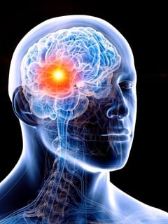 ਬ੍ਰੇਨ ਟਿਊਮਰ ਕਿਉਂ ਹੁੰਦਾ ਹੈ? ਇਸ ਤੋਂ ਕਿਵੇਂ ਕੀਤਾ ਜਾਵੇ ਬਚਾਅ...