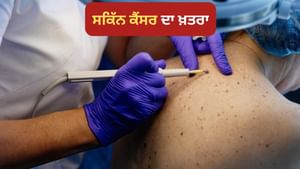 ਸਕਿੱਨ ਕੈਂਸਰ ਦਾ ਕਿਸ ਨੂੰ ਹੁੰਦਾ ਹੈ ਖ਼ਤਰਾ, ਕੀ ਹੁੰਦੇ ਹਨ ਇਹਦੇ ਲੱਛਣ ? ਸਕਿੱਨ ਕੈਂਸਰ ਦਾ ਕਿਸ ਨੂੰ ਹੁੰਦਾ ਹੈ ਖ਼ਤਰਾ, ਕੀ ਹੁੰਦੇ ਹਨ ਇਹਦੇ ਲੱਛਣ ?