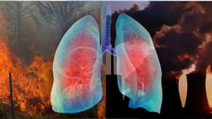 ਤੁਹਾਡੇ ਫੇਫੜਿਆਂ ਨੂੰ ਕਿੰਨਾ ਨੁਕਸਾਨ ਪਹੁੰਚਾ ਰਿਹਾ ਹੈ ਪ੍ਰਦੂਸ਼ਣ? ਜਾਣੋ ਤੁਹਾਡੇ ਫੇਫੜਿਆਂ ਨੂੰ ਕਿੰਨਾ ਨੁਕਸਾਨ ਪਹੁੰਚਾ ਰਿਹਾ ਹੈ ਪ੍ਰਦੂਸ਼ਣ? ਜਾਣੋ
