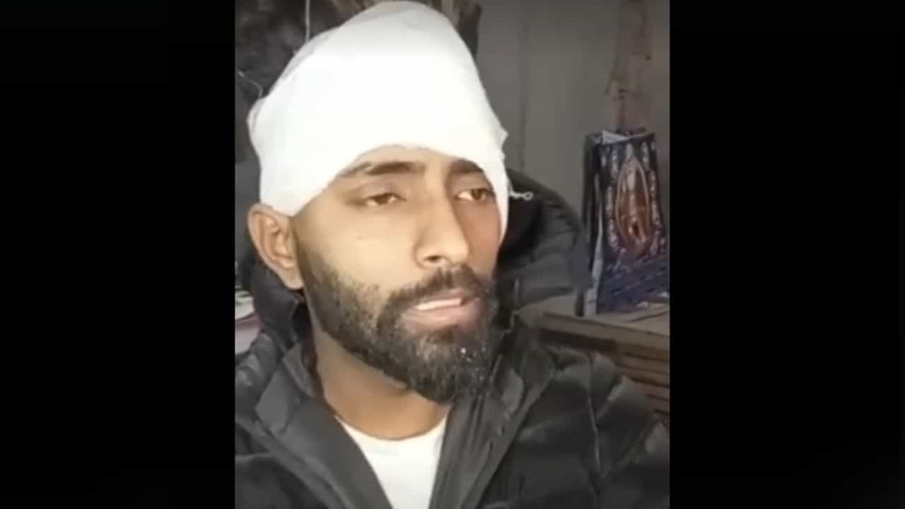 ਜਲੰਧਰ: ਚਾਈਨੀਜ਼ ਡੋਰ ਫਿਰ ਬਣੀ ਜਾਨਲੇਵਾ, ਕੱਟਿਆ ਗਿਆ ਨੌਜਵਾਨ ਦਾ ਕੰਨ; ਲੱਗੇ 15 ਟਾਂਕੇ