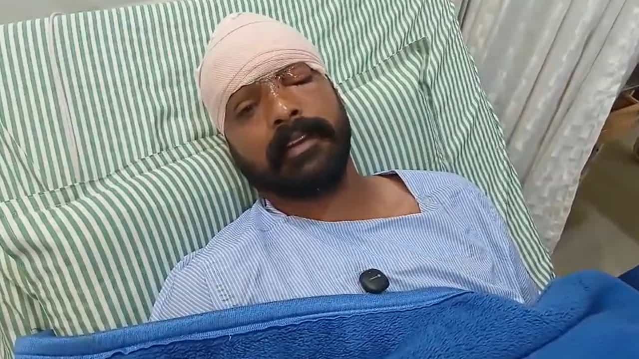 ਗੁਰਦਾਸਪੁਰ: ਚਾਈਨਾ ਡੋਰ ਦਾ ਕਹਿਰ, ਨੌਜਵਾਨ ਦਾ ਮੱਥਾ, ਨੱਕ ਤੇ ਭਰਵੱਟੇ ਜ਼ਖ਼ਮੀ, ਲੱਗੇ 35 ਟਾਂਕੇ