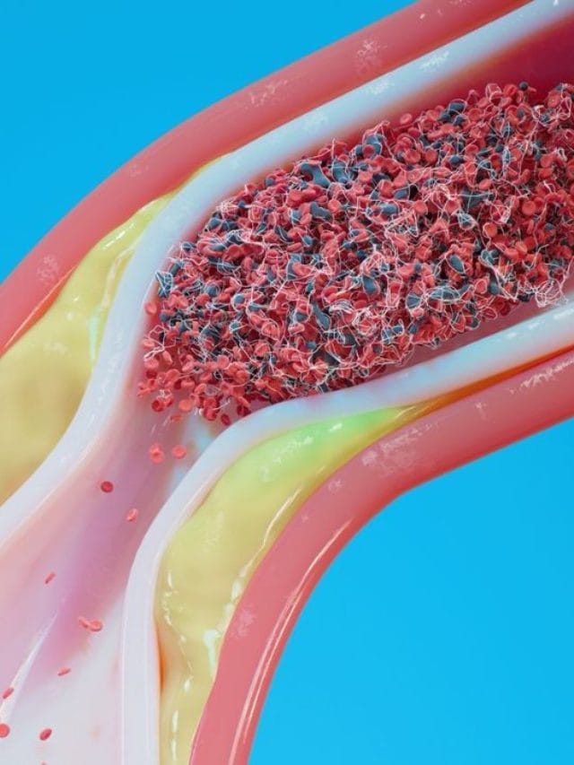 ਕੋਲੈਸਟ੍ਰੋਲ ਨੂੰ ਕੰਟਰੋਲ ਕਰਨ ਲਈ ਕੀ ਖਾਣਾ ਚਾਹੀਦਾ ਹੈ?