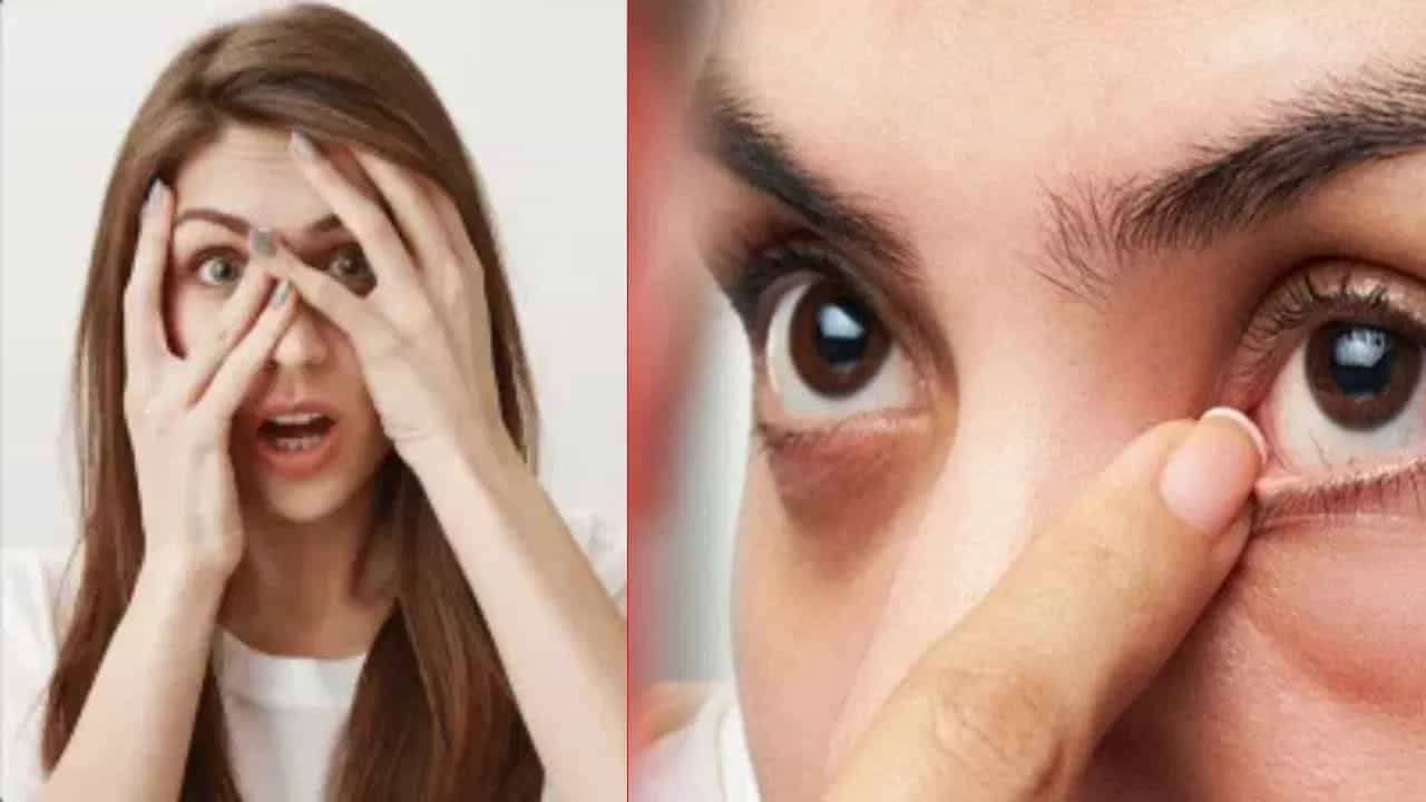 Shakun Apshakun: ਅੱਖਾਂ ਦਾ ਫੜਕਣਾ ਸ਼ੁਭ ਹੈ ਜਾਂ ਅਸ਼ੁਭ? ਜਾਣੋ ਮਰਦਾਂ ਅਤੇ ਔਰਤਾਂ ਲਈ ਇਸ ਦੇ ਵੱਖ-ਵੱਖ ਮਤਲਬ ਅਤੇ ਸੰਕੇਤ
