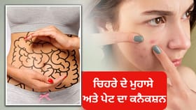 ਚਿਹਰੇ ਦੇ ਮੁਹਾਸੇ ਅਤੇ ਪੇਟ ਦੇ ਵਿਚਕਾਰ ਕੀ ਹੈ ਕਨੈਕਸ਼ਨ, ਆਯੁਰਵੈਦਿਕ ਮਾਹਰ ਤੋਂ ਸਮਝੋ...