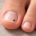 Samudrik Shastra: ਕੀ ਤੁਹਾਡੇ ਪੈਰਾਂ ਦੇ ਨਹੁੰਆਂ ‘ਤੇ ਵੀ ਹੈ ਤਿਲ? ਜਾਣੋ ਸਾਮੁਦਰਿਕ ਸ਼ਾਸਤਰ ਅਨੁਸਾਰ ਇਹ ਸ਼ੁਭ ਹੈ ਜਾਂ ਅਸ਼ੁਭ