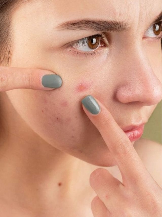 5 ਹਰੇ ਪੱਤੇ ਜੋ ਫੋੜੇ ਅਤੇ ਮੁਹਾਸੇ ਹਟਾਉਣ 'ਚ ਮਦਦ ਕਰਦੇ ਹਨ