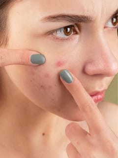 5 ਹਰੇ ਪੱਤੇ ਜੋ ਫੋੜੇ ਅਤੇ ਮੁਹਾਸੇ ਹਟਾਉਣ ‘ਚ ਮਦਦ ਕਰਦੇ ਹਨ...