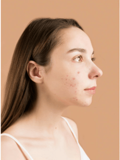 ਸਕਿਨ ‘ਤੇ ਰੰਗ ਨਾਲ ਪੈ ਗਏ ਦਾਗ, ਤਾਂ ਲਗਾਓ ਇਹ ਦੇਸੀ ਚੀਜਾਂ...