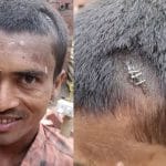 Viral Video: ਬੰਦੇ ਦਾ ਸਿਰ ਫਟਿਆ ਤਾਂ ਡਾਕਟਰ ਨੇ ਟਾਂਕਿਆਂ ਦੀ ਬਜਾਏ ਲਗਾਏ ਸਟੈਪਲਰ ਪਿੰਨ, ਵੀਡੀਓ ਹੋਇਆ ਵਾਇਰਲ