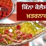 ਬੈਡ ਕੋਲੈਸਟ੍ਰੋਲ ਨੂੰ ਹਲਕੇ ‘ਚ ਲੈਣਾ ਪਵੇਗਾ ਭਾਰੀ! ਨਵੀਂ ਗਾਈਡਲਾਈਨ ‘ਚ ਤੈਅ ਹੋਇਆ ਸੁਰੱਖਿਅਤ ਲੈਵਲ