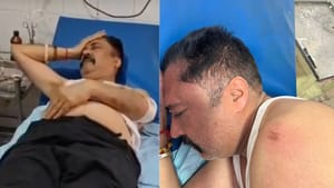 ਲੁਧਿਆਣਾ 'ਚ ਸ਼ਿਵ ਸੈਨਾ ਆਗੂ ਰਾਜਨ ਰਾਣਾ 'ਤੇ ਕਾਤਲਾਨਾ ਹਮਲਾ, ਹਸਪਤਾਲ ਦਾਖ਼ਲ