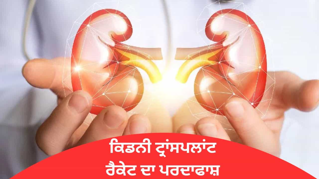 ਮੋਹਾਲੀ ਚ ਚਲਾ ਰਿਹਾ ਸੀ ਕਿਡਨੀ ਟ੍ਰਾਂਸਪਲਾਂਟ ਰੈਕੇਟ, 25 ਲੱਖ ਵਿੱਚ ਹੁੰਦਾ ਸੀ ਸੌਦਾ, ਨੇਪਾਲ ਤੋਂ ਲਿਆਂਦੇ ਡੋਨਰ; ਮੁੱਖ ਮੁਲਜ਼ਮ ਫਰਾਰ