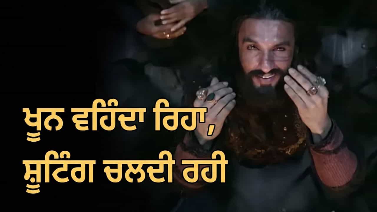 ਚੱਕਰ, ਉਲਟੀ ਅਤੇ ਸੱਟ ਦੇ ਬਾਵਜੂਦ ਪੂਰਾ ਕੀਤਾ ਖਲੀ ਬਲੀ ਗਾਣਾ, ਰਣਵੀਰ ਸਿੰਘ ਨੇ ਬਣਾਇਆ ਇਸ ਨੂੰ ਯਾਦਗਾਰ