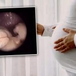 Viral: ਮਾਂ ਦੇ ਗਰਭ ਵਿੱਚ ਇੰਝ ਦਿਖਦਾ ਹੈ 20 ਹਫ਼ਤਿਆਂ ਦਾ ਬੱਚਾ, ਸਾਹਮਣੇ ਆਇਆ ਅਲਟਰਾਸਾਊਂਡ ਦਾ ਇਹ ਕਲੀਅਰ ਵੀਡੀਓ