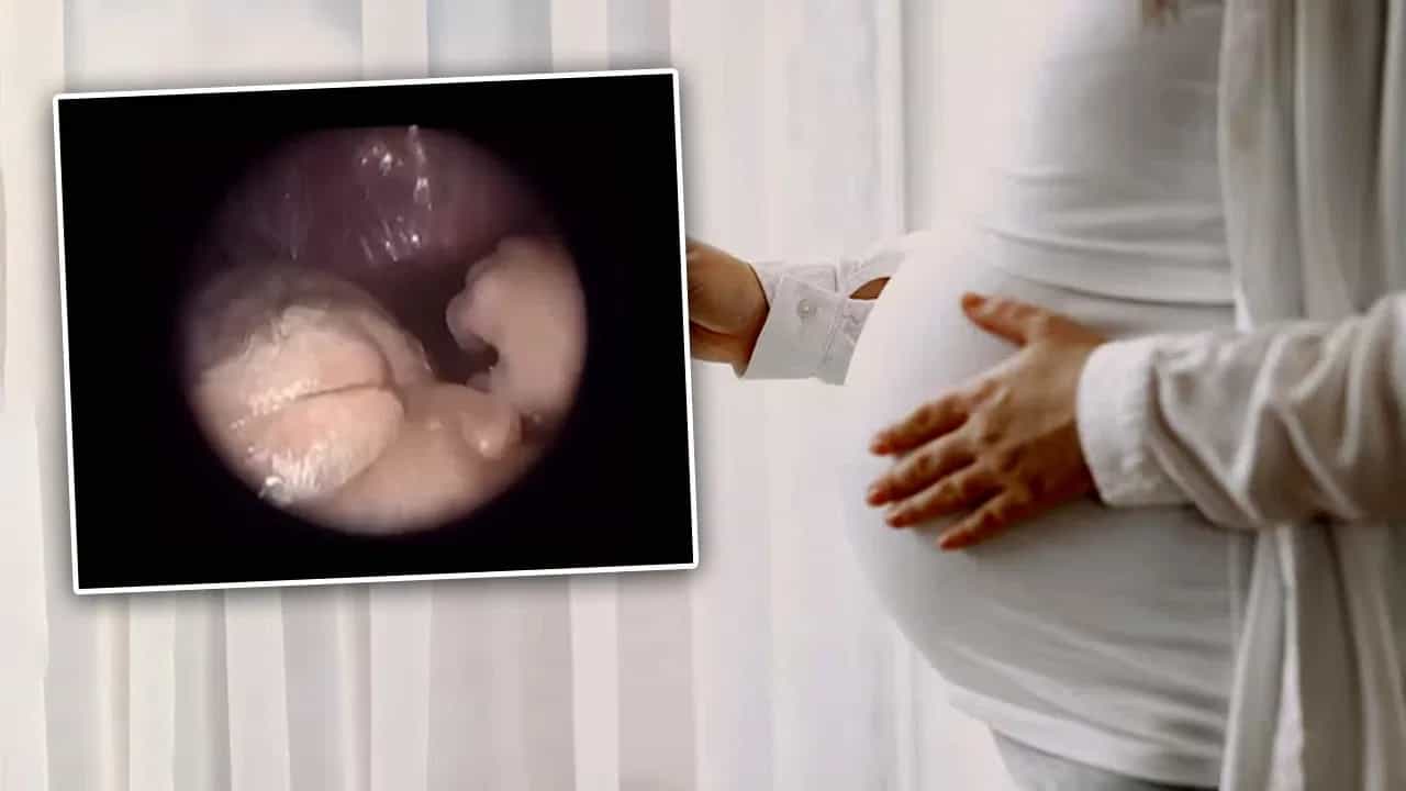 Viral: ਮਾਂ ਦੇ ਗਰਭ ਵਿੱਚ ਇੰਝ ਦਿਖਦਾ ਹੈ 20 ਹਫ਼ਤਿਆਂ ਦਾ ਬੱਚਾ, ਸਾਹਮਣੇ ਆਇਆ ਅਲਟਰਾਸਾਊਂਡ ਦਾ ਇਹ ਕਲੀਅਰ ਵੀਡੀਓ